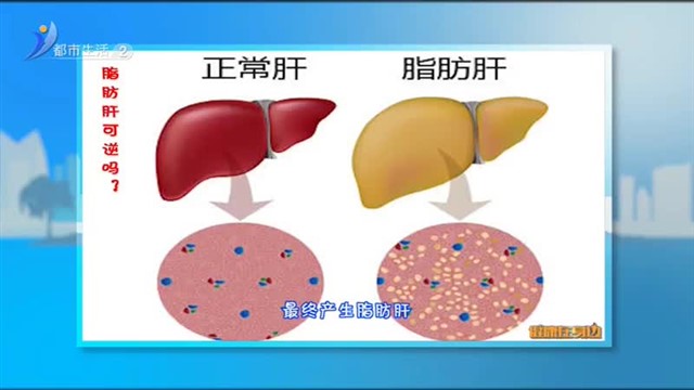 脂肪肝可逆吗？肝脏“减肥秘籍”请收好