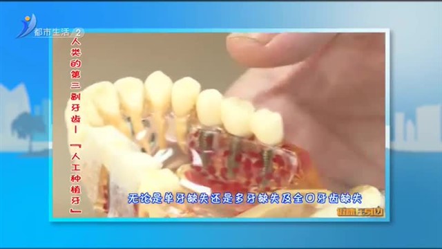 人类的第三副牙齿—“人工种植牙”【威海广电讯】